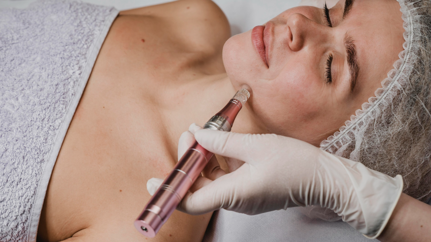 Dermapen-behandling